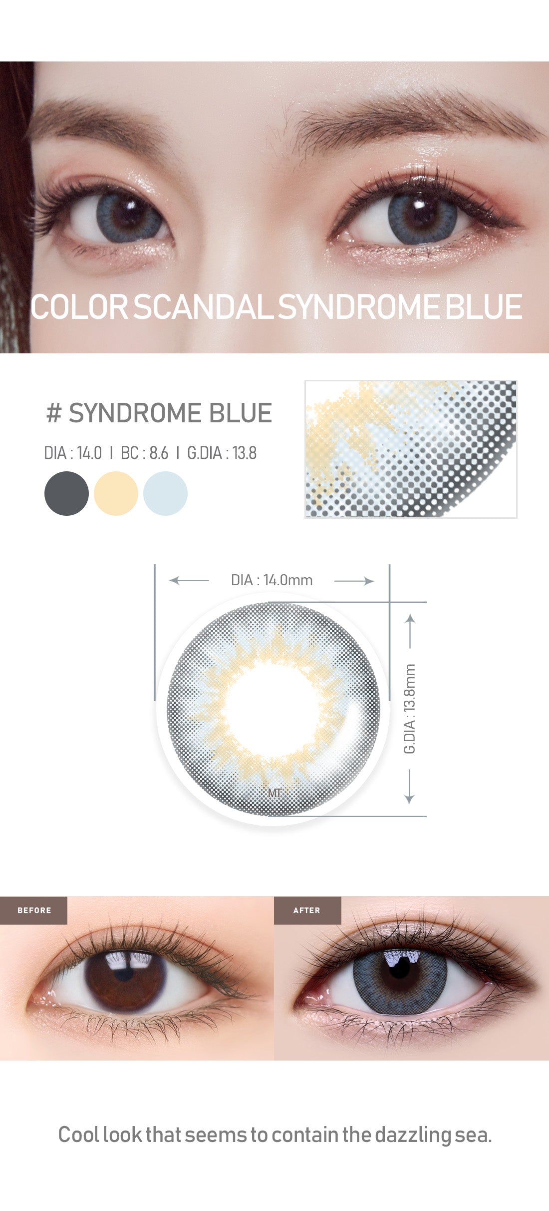 [Select Period] Torica Syndrome Blue