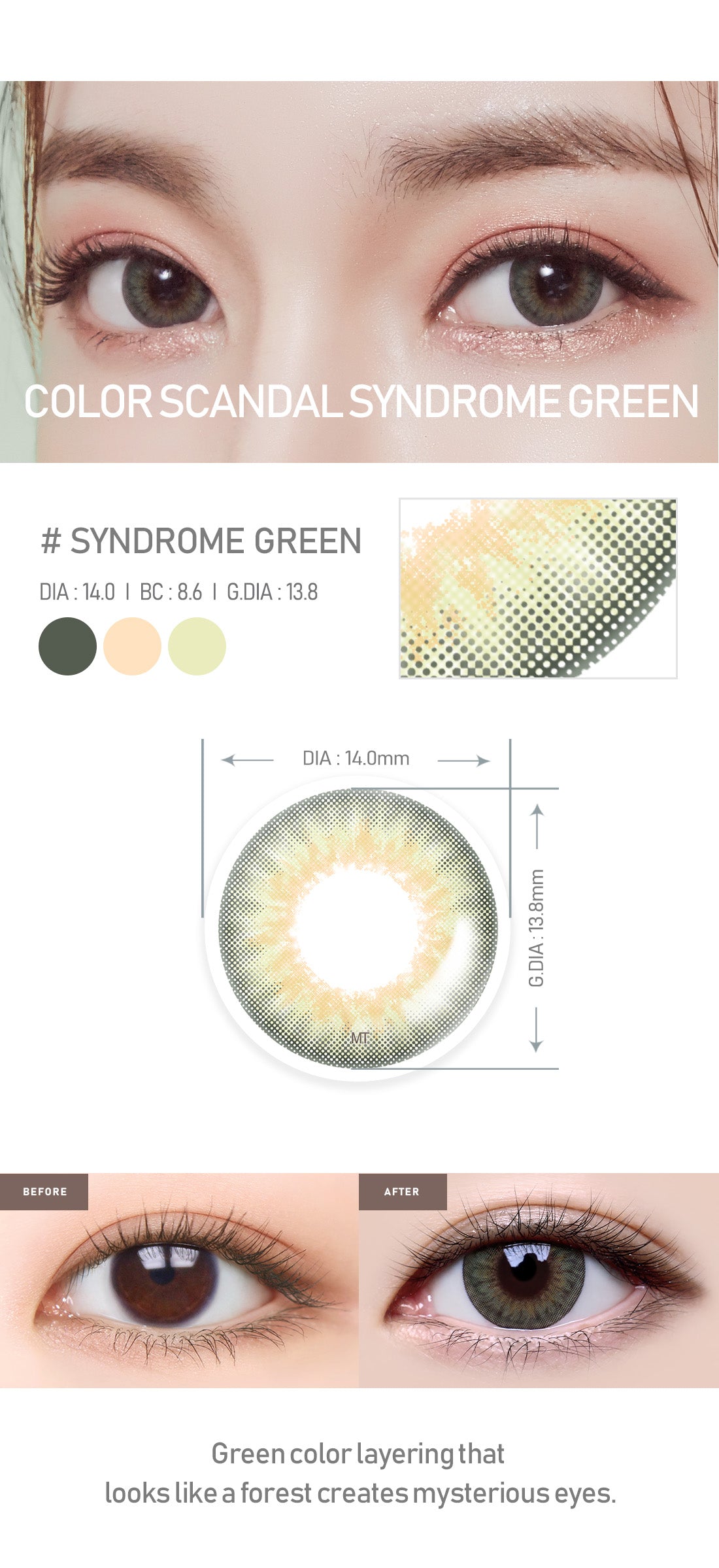 [Select Period] Torica Syndrome Green
