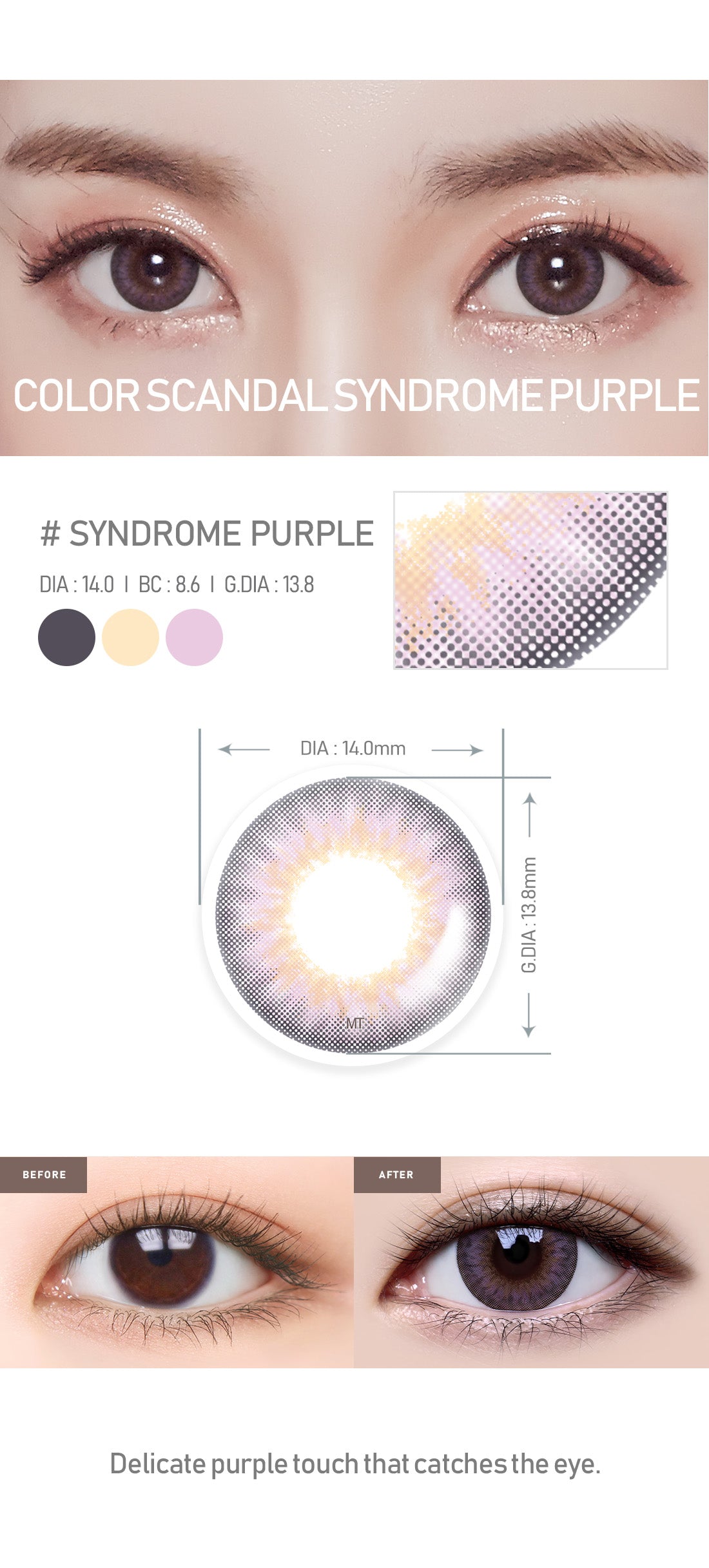 [Select Period] Torica Syndrome Purple